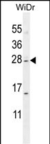 IQCF1 Antibody (N-term) (Cat. #AP52228PU-N) western blot analysis in WiDr cell line lysates (35ug/lane).This demonstrates the IQCF1 antibody detected the IQCF1 protein (arrow).