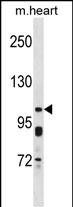 KCNQ5 Antibody (C-term) (Cat. #AP52318PU-N) western blot analysis in mouse heart tissue lysates (35ug/lane).This demonstrates the KCNQ5 antibody detected the KCNQ5 protein (arrow).