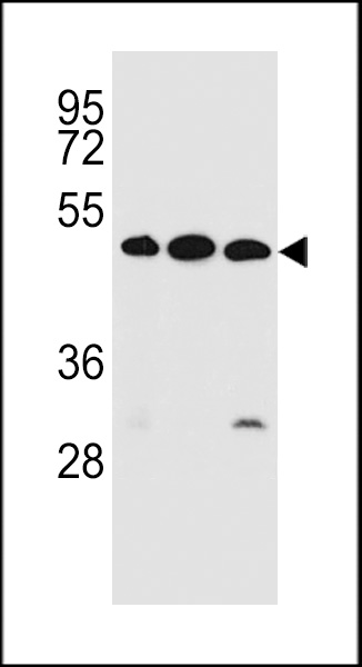 KREMEN2 Antibody (Center) (Cat. #AP52408PU-N) western blot analysis in ZR-75-1,K562,NCI-H460 cell line lysates (35ug/lane).This demonstrates the KREMEN2 antibody detected the KREMEN2 protein (arrow).