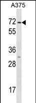 KRT75 Antibody (N-term) (Cat. #AP16811a) western blot analysis in A375 cell line lysates (35ug/lane).This demonstrates the KRT75 antibody detected the KRT75 protein (arrow).