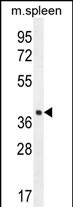 LHFPL5 Antibody (C-term) (Cat. #AP52475PU-N) western blot analysis in mouse spleen tissue lysates (35ug/lane).This demonstrates the LHFPL5 antibody detected the LHFPL5 protein (arrow).