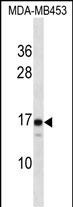 LIM2 Antibody (C-term) (Cat. #AP52483PU-N) western blot analysis in MDA-MB453 cell line lysates (35ug/lane).This demonstrates the LIM2 antibody detected the LIM2 protein (arrow).