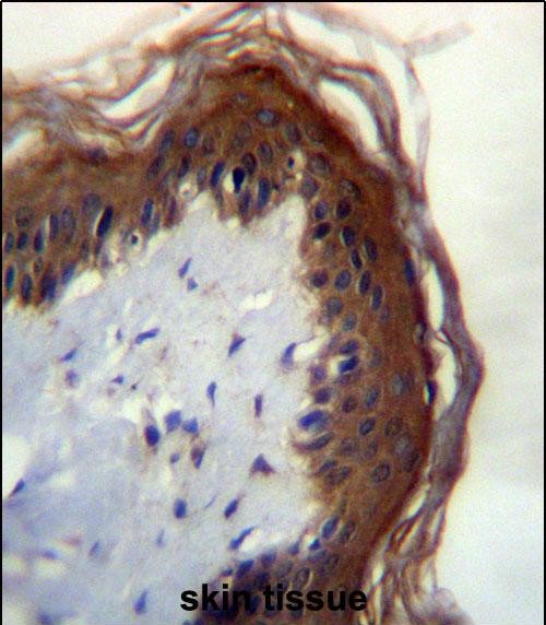 LIPM Antibdy (C-term) (Cat. #AP52498PU-N)immunohistochemistry analysis in formalin fixed and paraffin embedded human skin tissue followed by peroxidase conjugation of the secondary antibody and DAB staining.This data demonstrates the use of LIPM Antibdy (C-term) for immunohistochemistry.  Clinical relevance has not been evaluated.