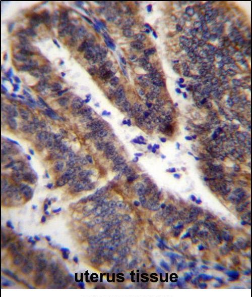 LRRN4CL Antibody (Center) (Cat. #AP52548PU-N)immunohistochemistry analysis in formalin fixed and paraffin embedded human uterus tissue followed by peroxidase conjugation of the secondary antibody and DAB staining.This data demonstrates the use of LRRN4CL Antibody (Center) for immunohistochemistry.  Clinical relevance has not been evaluated.