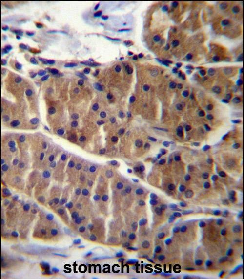 LRSAM1 Antibody (N-term) (Cat. #AP12973a)immunohistochemistry analysis in formalin fixed and paraffin embedded human stomach tissue followed by peroxidase conjugation of the secondary antibody and DAB staining.This data demonstrates the use of LRSAM1 Antibody (N-term) for immunohistochemistry.  Clinical relevance has not been evaluated.