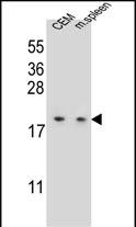 LSM7 Antibody (C-term) (Cat. #AP52555PU-N) western blot analysis in CEM cell line and mouse spleen tissue lysates (35ug/lane).This demonstrates the LSM7 antibody detected the LSM7 protein (arrow).