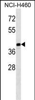 MAGEB10 Antibody (Center) (Cat. #AP52586PU-N) western blot analysis in NCI-H460 cell line lysates (35ug/lane).This demonstrates the MAGEB10 antibody detected the MAGEB10 protein (arrow).