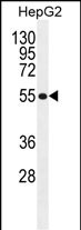 MFS10 Antibody  (Center) (Cat. #AP52680PU-N) western blot analysis in HepG2 cell line lysates (35ug/lane).This demonstrates the MFS10 antibody detected the MFS10 protein (arrow).