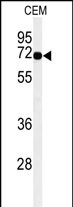Western blot analysis of MFSD6 Antibody  (C-term) (Cat. #AP52683PU-N) in CEM cell line lysates (35ug/lane). MFSD6 (arrow) was detected using the purified Pab.