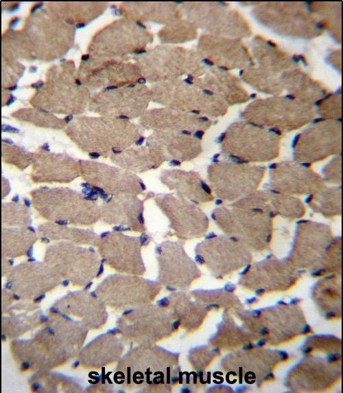 MGAT4C Antibody (C-term) (Cat. #AP52686PU-N)immunohistochemistry analysis in formalin fixed and paraffin embedded human skeletal muscle followed by peroxidase conjugation of the secondary antibody and DAB staining.This data demonstrates the use of MGAT4C Antibody (C-term) for immunohistochemistry.  Clinical relevance has not been evaluated.