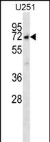MKKS Antibody (C-term) (Cat. #AP52702PU-N) western blot analysis in U251 cell line lysates (35ug/lane).This demonstrates the MKKS antibody detected the MKKS protein (arrow).