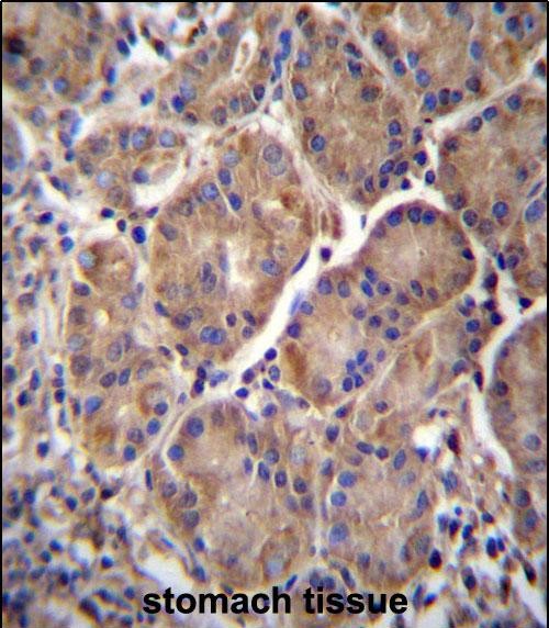 MMRN2 Antibody (C-term) (Cat. #AP52714PU-N)immunohistochemistry analysis in formalin fixed and paraffin embedded human stomach tissue followed by peroxidase conjugation of the secondary antibody and DAB staining.This data demonstrates the use of MMRN2 Antibody (C-term) for immunohistochemistry.  Clinical relevance has not been evaluated.