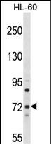 MTMR6 Antibody (N-term) (Cat. #AP16543a) western blot analysis in HL-60 cell line lysates (35ug/lane).This demonstrates the MTMR6 antibody detected the MTMR6 protein (arrow).