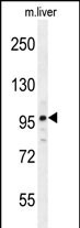 NARG2 Antibody  (N-term) (Cat. #AP52811PU-N) western blot analysis in mouse liver tissue lysates (35ug/lane).This demonstrates the NARG2 antibody detected the NARG2 protein (arrow).
