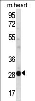 NCCRP1 Antibody (C-term) (Cat. #AP12510b) western blot analysis in mouse heart tissue lysates (35ug/lane).This demonstrates the NCCRP1 antibody detected the NCCRP1 protein (arrow).