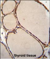 NFKBID Antibody (N-term) (Cat. #AP52864PU-N)immunohistochemistry analysis in formalin fixed and paraffin embedded human thyroid tissue followed by peroxidase conjugation of the secondary antibody and DAB staining.This data demonstrates the use of NFKBID Antibody (N-term) for immunohistochemistry.  Clinical relevance has not been evaluated.