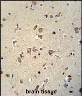 NIPA4 antibody (N-term) (Cat. #AP52877PU-N) immunohistochemistry analysis in formalin fixed and paraffin embedded human brain tissue followed by peroxidase conjugation of the secondary antibody and DAB staining.  This data demonstrates the use of the NIPA4 antibody (N-term) for immunohistochemistry.  Clinical relevance has not been evaluated.