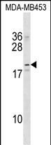 NKAIN2 Antibody (Center) (Cat. #AP52883PU-N) western blot analysis in MDA-MB453 cell line lysates (35ug/lane).This demonstrates the NKAIN2 antibody detected the NKAIN2 protein (arrow).