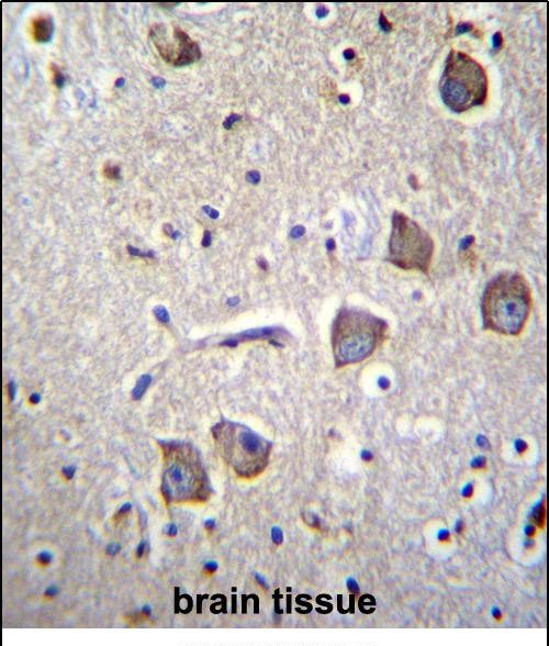 NRN1L Antibody (Center) (Cat. #AP52938PU-N)immunohistochemistry analysis in formalin fixed and paraffin embedded human brain tissue followed by peroxidase conjugation of the secondary antibody and DAB staining.This data demonstrates the use of NRN1L Antibody (Center) for immunohistochemistry.  Clinical relevance has not been evaluated.