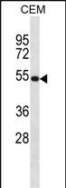 NTN3 Antibody (C-term) (Cat. #AP52952PU-N) western blot analysis in CEM cell line lysates (35ug/lane).This demonstrates the NTN3 antibody detected the NTN3 protein (arrow).