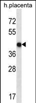 OR10V1 Antibody (C-term) (Cat. #AP53013PU-N) western blot analysis in human placenta tissue lysates (35ug/lane).This demonstrates the OR10V1 antibody detected the OR10V1 protein (arrow).