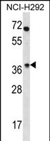 OR4N2 Antibody (N-term) (Cat. #AP53064PU-N) western blot analysis in NCI-H292 cell line lysates (35ug/lane).This demonstrates the OR4N2 antibody detected the OR4N2 protein (arrow).