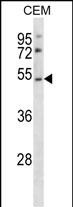 P2RY2 Antibody (C-term) (Cat. #AP53144PU-N) western blot analysis in CEM cell line lysates (35ug/lane).This demonstrates the P2RY2 antibody detected the P2RY2 protein (arrow).