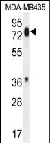 PCDHB13 Antibody (Center) (Cat. #AP53208PU-N) western blot analysis in MDA-MB435 cell line lysates (35ug/lane).This demonstrates the PCDHB13 antibody detected the PCDHB13 protein (arrow).