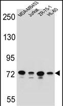 PCDHB15 Antibody (N-term) (Cat. #AP53210PU-N) western blot analysis in MDA-MB453,Jurkat,ZR-75-1,HL-60 cell line lysates (35ug/lane).This demonstrates the PCDHB15 antibody detected the PCDHB15 protein (arrow).