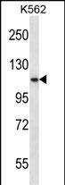 PCSK6 Antibody (C-term) (Cat. #AP53222PU-N) western blot analysis in K562 cell line lysates (35ug/lane).This demonstrates the PCSK6 antibody detected the PCSK6 protein (arrow).