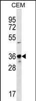 PDC Antibody (Center) (Cat. #AP53227PU-N) western blot analysis in CEM cell line lysates (35ug/lane).This demonstrates the PDC antibody detected the PDC protein (arrow).