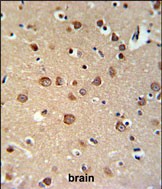 PDE6C Antibody (Center) (Cat. #AP53238PU-N) IHC analysis in formalin fixed and paraffin embedded brain tissue followed by peroxidase conjugation of the secondary antibody and DAB staining.  This data demonstrates the use of the PDE6C Antibody (Center) for immunohistochemistry.  Clinical relevance has not been evaluated.