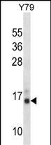 PFN2 Antibody (C-term) (Cat. #AP53264PU-N) western blot analysis in Y79 cell line lysates (35ug/lane).This demonstrates the PFN2 antibody detected the PFN2 protein (arrow).