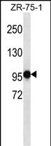 PHF14 Antibody (N-term) (Cat. #AP53281PU-N) western blot analysis in ZR-75-1 cell line lysates (35ug/lane).This demonstrates the PHF14 antibody detected the PHF14 protein (arrow).