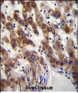 PHF20 Antibody (N-term) (Cat. #AP53282PU-N)immunohistochemistry analysis in formalin fixed and paraffin embedded human liver tissue followed by peroxidase conjugation of the secondary antibody and DAB staining.This data demonstrates the use of PHF20 Antibody (N-term) for immunohistochemistry.  Clinical relevance has not been evaluated.
