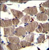 PION Antibody (C-term) (Cat. #AP53308PU-N)immunohistochemistry analysis in formalin fixed and paraffin embedded human skeletal muscle followed by peroxidase conjugation of the secondary antibody and DAB staining.This data demonstrates the use of PION Antibody (C-term) for immunohistochemistry.  Clinical relevance has not been evaluated.