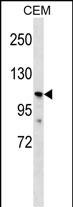 PKD2L1 Antibody (N-term) (Cat. #AP53315PU-N) western blot analysis in CEM cell line lysates (35ug/lane).This demonstrates the PKD2L1 antibody detected the PKD2L1 protein (arrow).