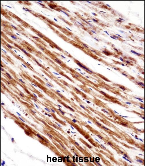 PLA2G5 Antibody (C-term) (AP53325PU-N)immunohistochemistry analysis in formalin fixed and paraffin embedded human heart tissue followed by peroxidase conjugation of the secondary antibody and DAB staining.This data demonstrates the use of PLA2G5 Antibody (C-term) for immunohistochemistry.  Clinical relevance has not been evaluated.