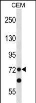 PRDM8 Antibody (N-term) (Cat. #AP53438PU-N) western blot analysis in CEM cell line lysates (35ug/lane).This demonstrates the PRDM8 antibody detected the PRDM8 protein (arrow).