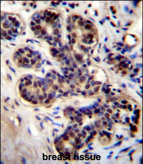 PROX2 Antibody (C-term) (Cat. #AP53453PU-N)immunohistochemistry analysis in formalin fixed and paraffin embedded human breast tissue followed by peroxidase conjugation of the secondary antibody and DAB staining.This data demonstrates the use of PROX2 Antibody (C-term) for immunohistochemistry.  Clinical relevance has not been evaluated.