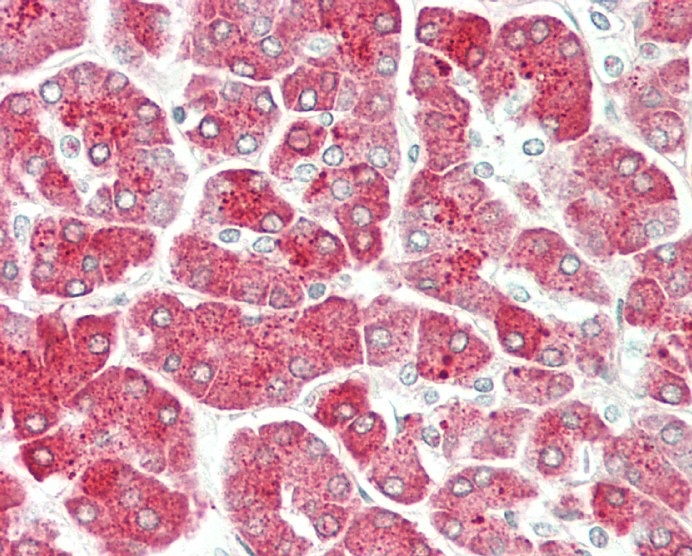 Formalin-fixed and paraffin-embedded H.pancreas tissue reacted with PRSS1 Antibody (Center) (Cat#AP53464PU-N).