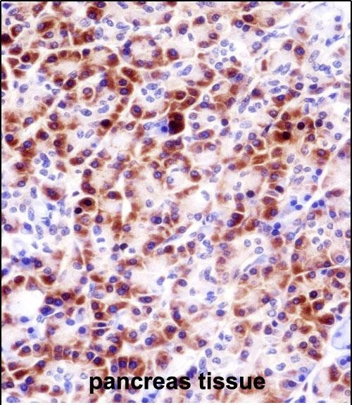 PRSS27 Antibody (C-term) (AP53468PU-N)immunohistochemistry analysis in formalin fixed and paraffin embedded human pancreas tissue followed by peroxidase conjugation of the secondary antibody and DAB staining.This data demonstrates the use of PRSS27 Antibody (C-term) for immunohistochemistry.  Clinical relevance has not been evaluated.