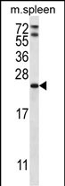 RAP1A Antibody (C-term) (Cat. #AP12949b) western blot analysis in mouse spleen tissue lysates (35ug/lane).This demonstrates the RAP1A antibody detected the RAP1A protein (arrow).