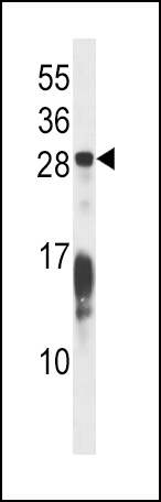 RAP1B Antibody (C-term) (Cat. #AP53579PU-N) western blot analysis in Hela cell line lysates (35ug/lane).This demonstrates the RAP1B antibody detected the RAP1B protein (arrow).