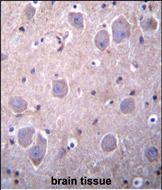 RAP1GDS1 Antibody (Center) (Cat. #AP53580PU-N)immunohistochemistry analysis in formalin fixed and paraffin embedded human brain tissue followed by peroxidase conjugation of the secondary antibody and DAB staining.This data demonstrates the use of RAP1GDS1 Antibody (Center) for immunohistochemistry.  Clinical relevance has not been evaluated.