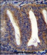RBPMS2 Antibody (Center) (Cat. #AP53619PU-N)immunohistochemistry analysis in formalin fixed and paraffin embedded human uterus tissue followed by peroxidase conjugation of the secondary antibody and DAB staining.This data demonstrates the use of RBPMS2 Antibody (Center) for immunohistochemistry.  Clinical relevance has not been evaluated.