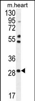 RNF183 Antibody (Center) (Cat. #AP53687PU-N) western blot analysis in mouse heart tissue lysates (35ug/lane).This demonstrates the RNF183 antibody detected the RNF183 protein (arrow).