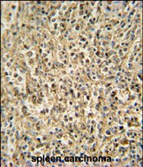 RNT2 antibody (N-term) (Cat. #AP53699PU-N) immunohistochemistry analysis in formalin fixed and paraffin embedded human spleen carcinoma followed by peroxidase conjugation of the secondary antibody and DAB staining.  This data demonstrates the use of the RNT2 antibody (N-term) for immunohistochemistry.  Clinical relevance has not been evaluated.