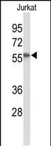 Western blot analysis of SACM1L Antibody (C-term) (Cat. #AP53789PU-N) in Jurkat cell line lysates (35ug/lane). SACM1L (arrow) was detected using the purified Pab.