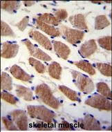 SAMD7 Antibody (Center) (Cat. #AP53792PU-N)immunohistochemistry analysis in formalin fixed and paraffin embedded human skeletal muscle followed by peroxidase conjugation of the secondary antibody and DAB staining.This data demonstrates the use of SAMD7 Antibody (Center) for immunohistochemistry.  Clinical relevance has not been evaluated.